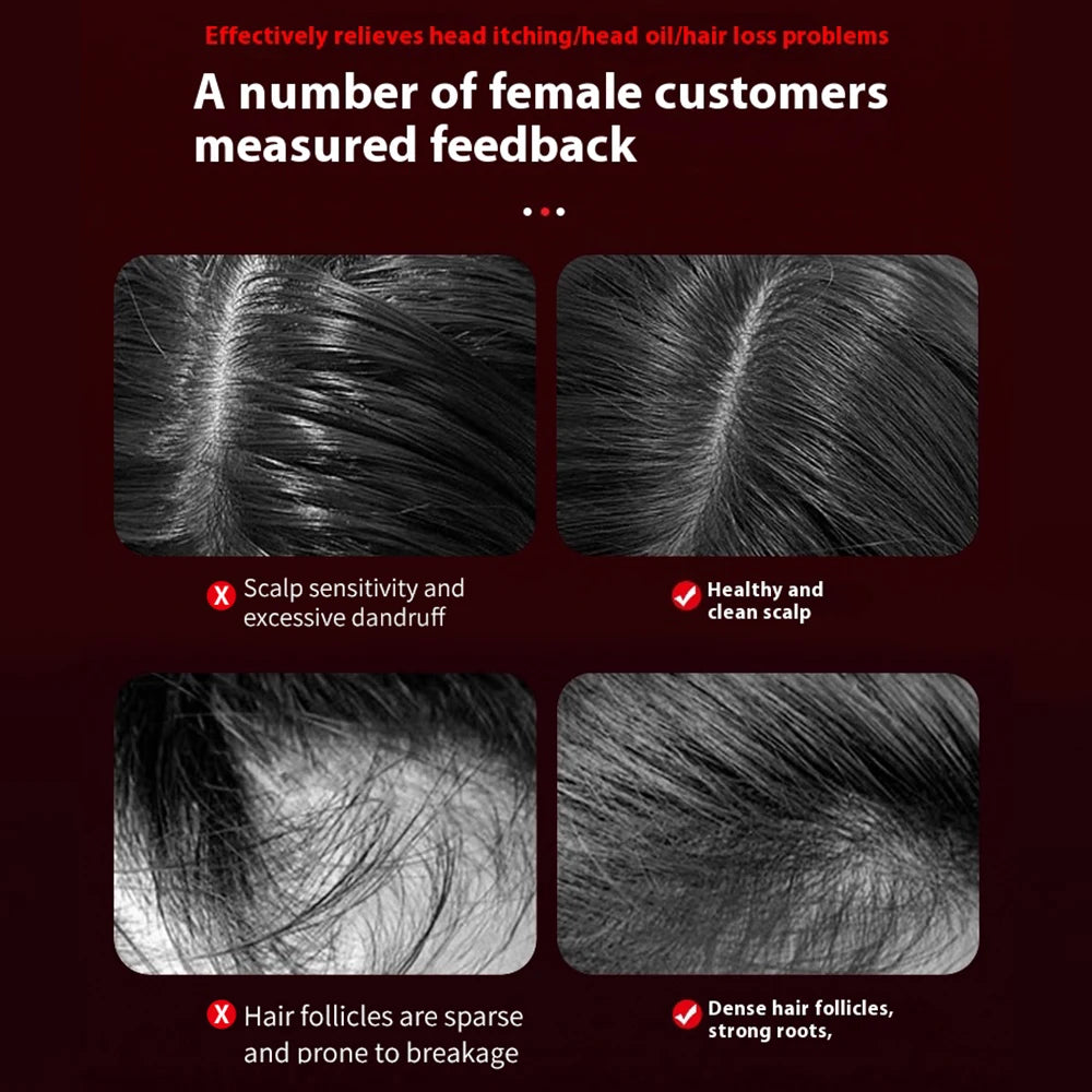 Electric Massage Comb 3 Modes Portable Red Light Laser Comb for Hair Follicles